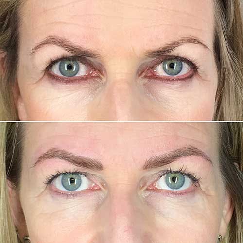 microblading