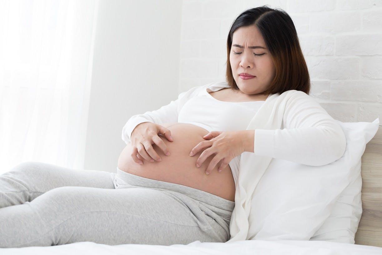 Graviditetskløe: Det skal du være opmærksom på