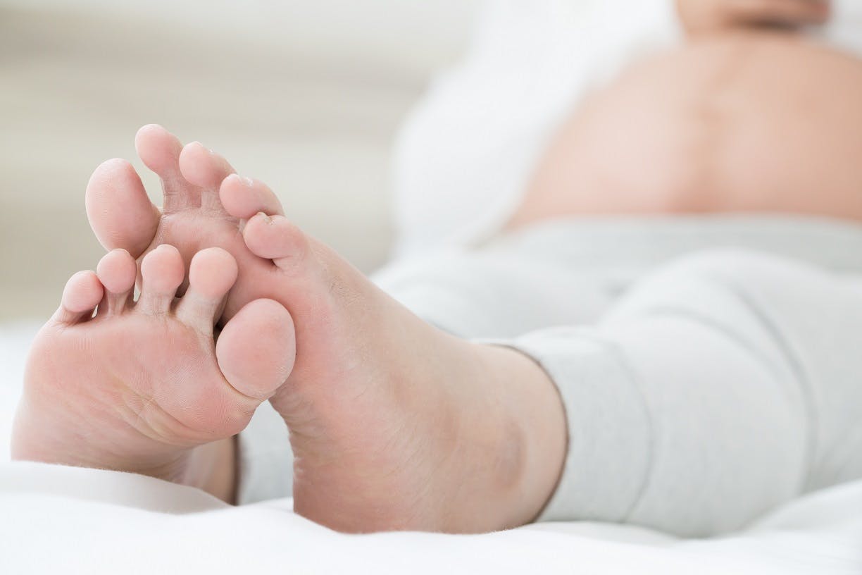 Graviditetskløe forekommer særligt under hænder og fødder