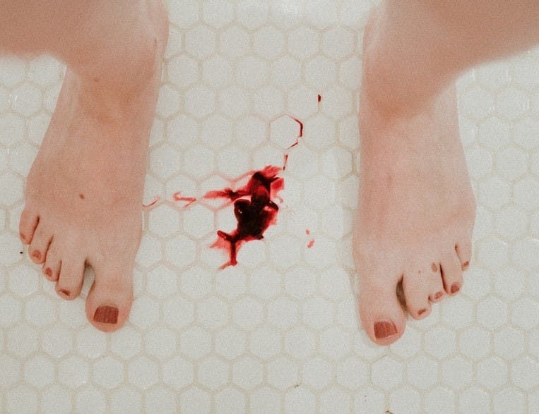 https://imgix.femina.dk/2022-02-28/uregelmaessig_menstruation_bloedningsforstyrrelser-2.jpg