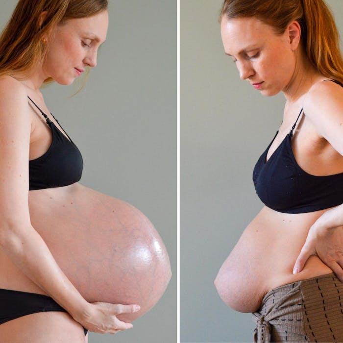 Gravide får at vide, at de stråler. Men efter fødslen er der stille