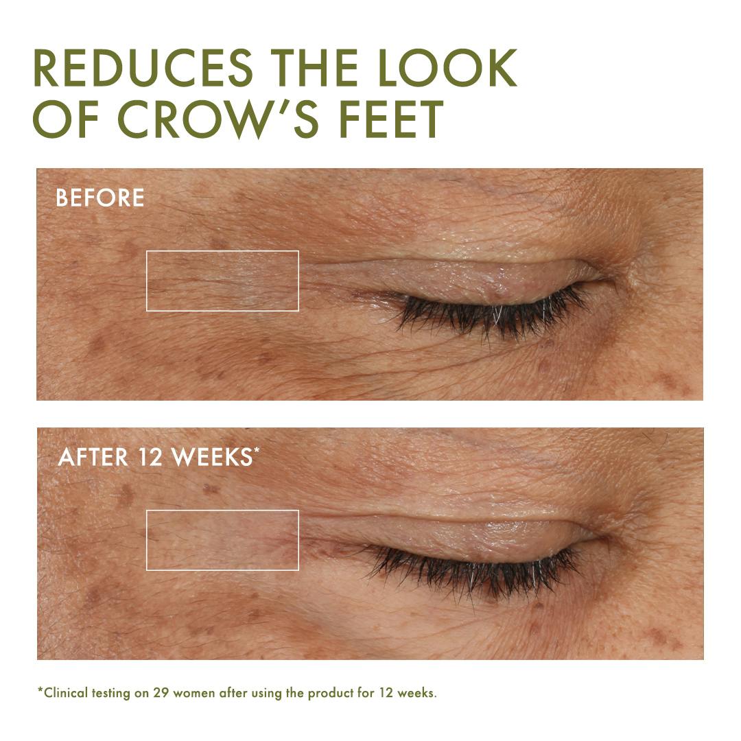 https://imgix.femina.dk/2023-01-31/OG_PX23_BEFORE_AFTER_CROWS_FEET_1080x1080_NA_EMEA_1.jpg