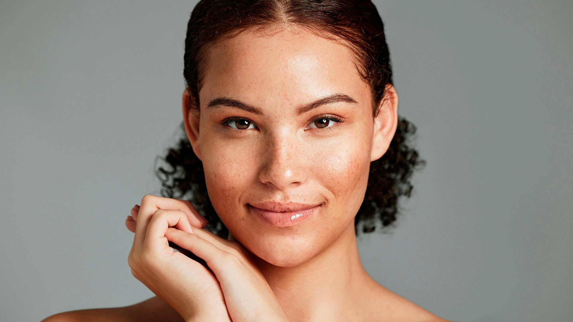 3 tips: Sådan kan du forebygge og reducere pigmentpletter