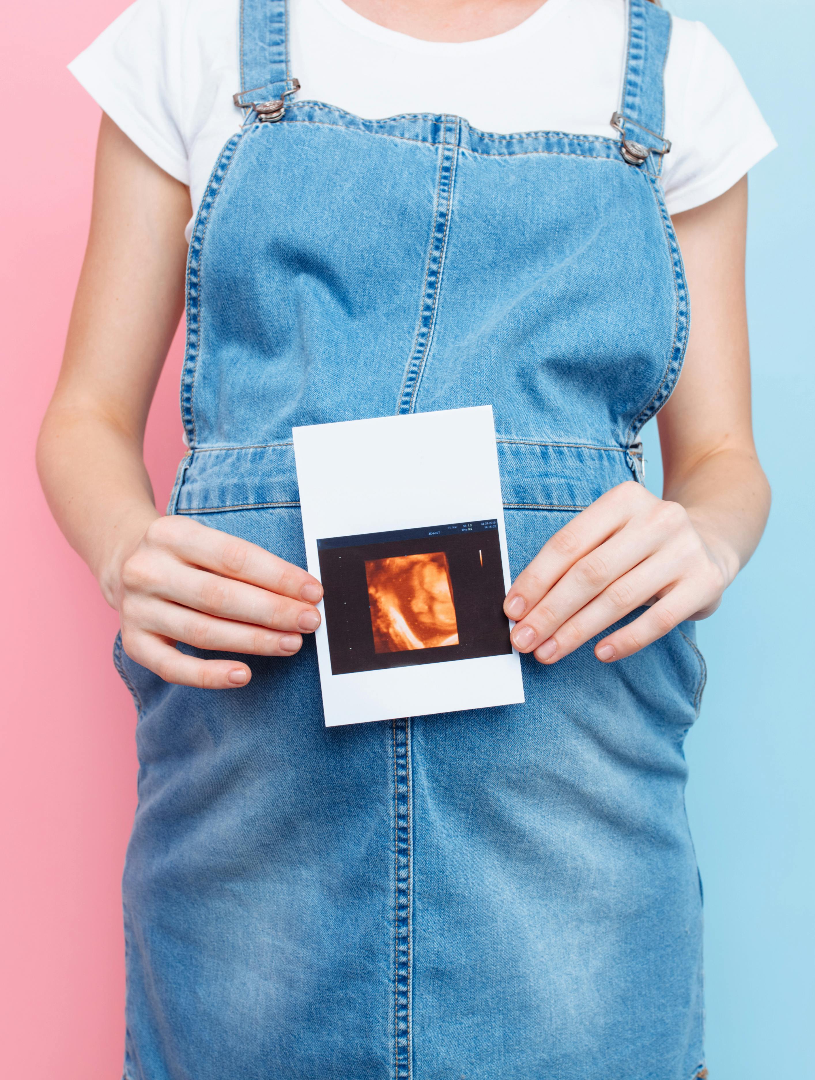 Dreng eller pige? Alt hvad du skal vide om kønsscanninger