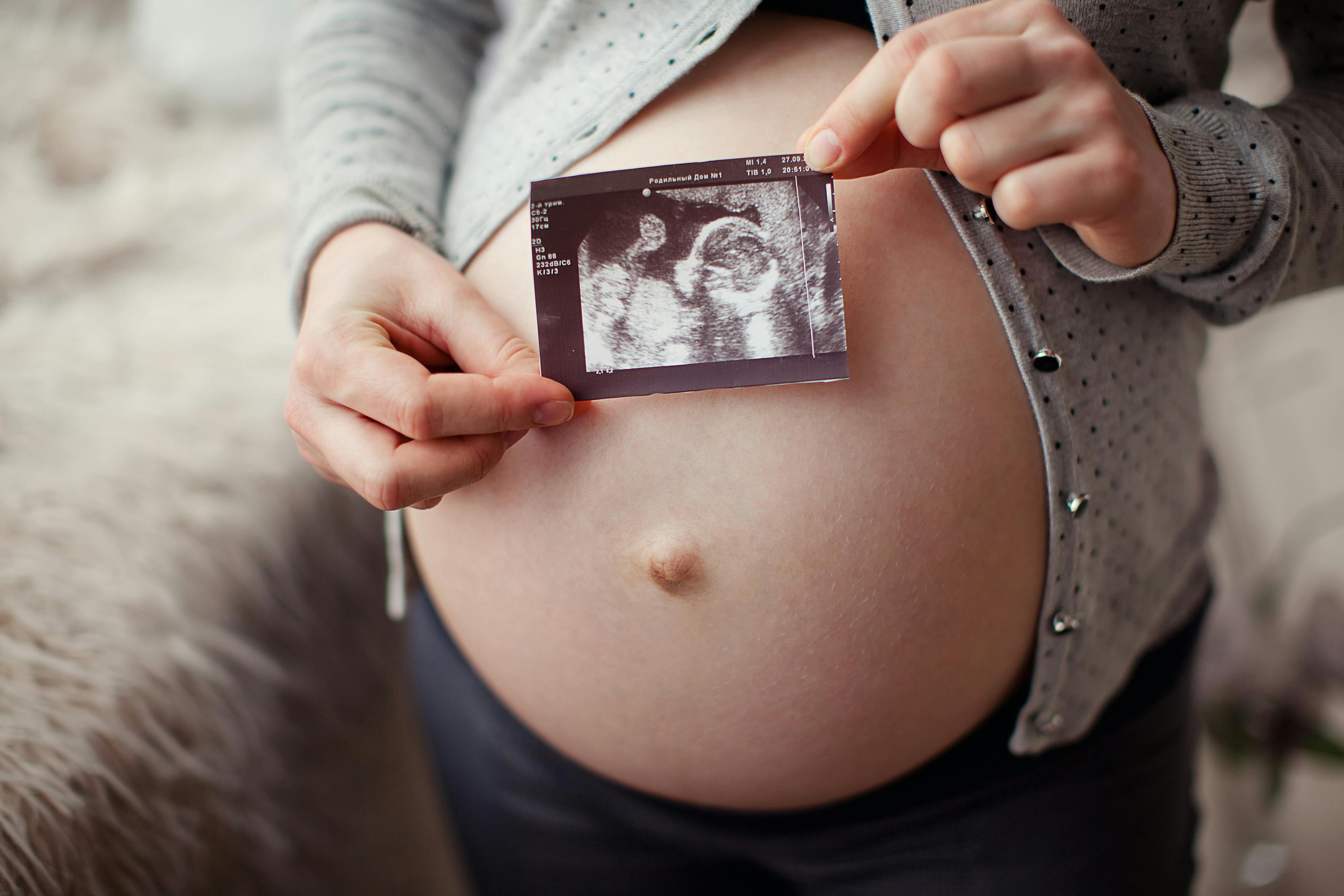 Hvornår skal man scannes som gravid?