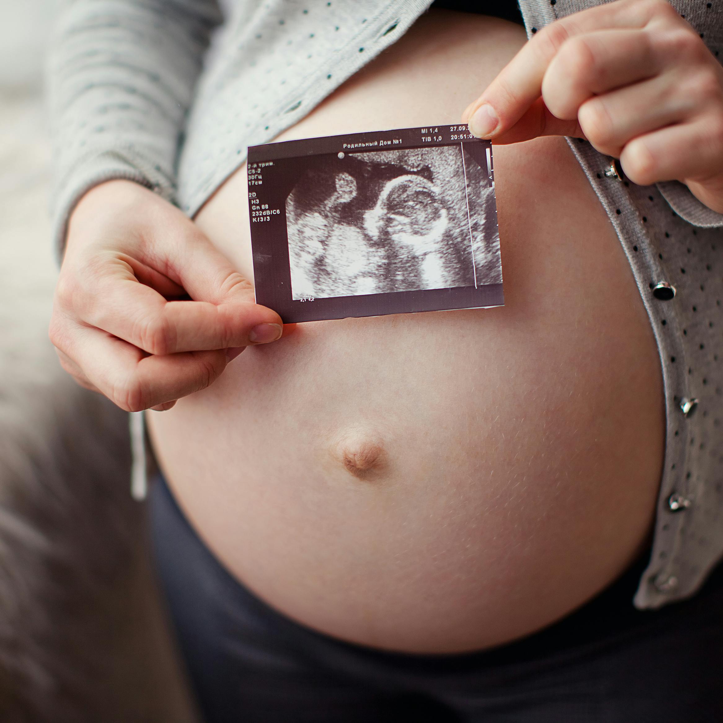 Hvornår bliver man scannet som gravid - Nakkefold, Kønsscanning og Misdannelsesscaning