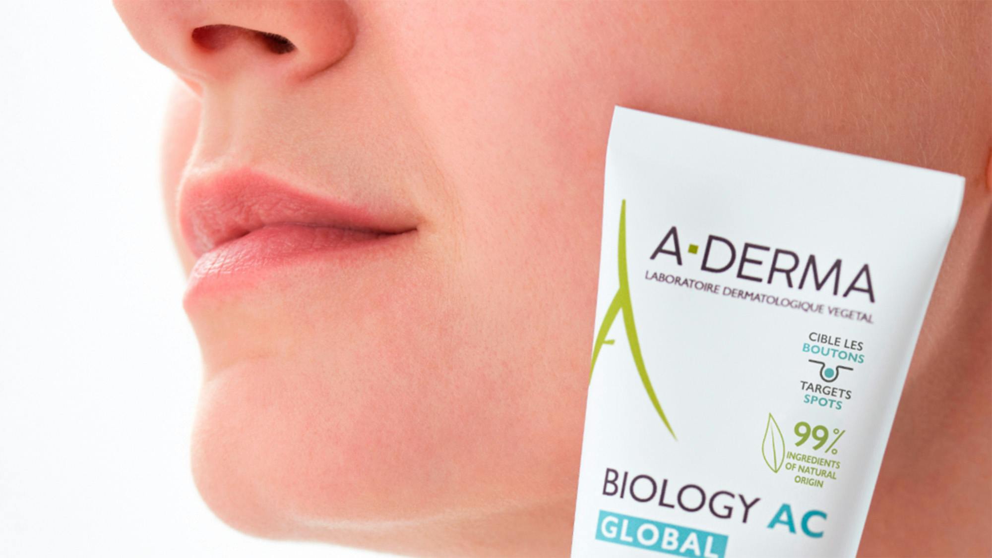 Har din eller teenagerens hud tendens til akne? Derfor bør du kende til mikrobiomet