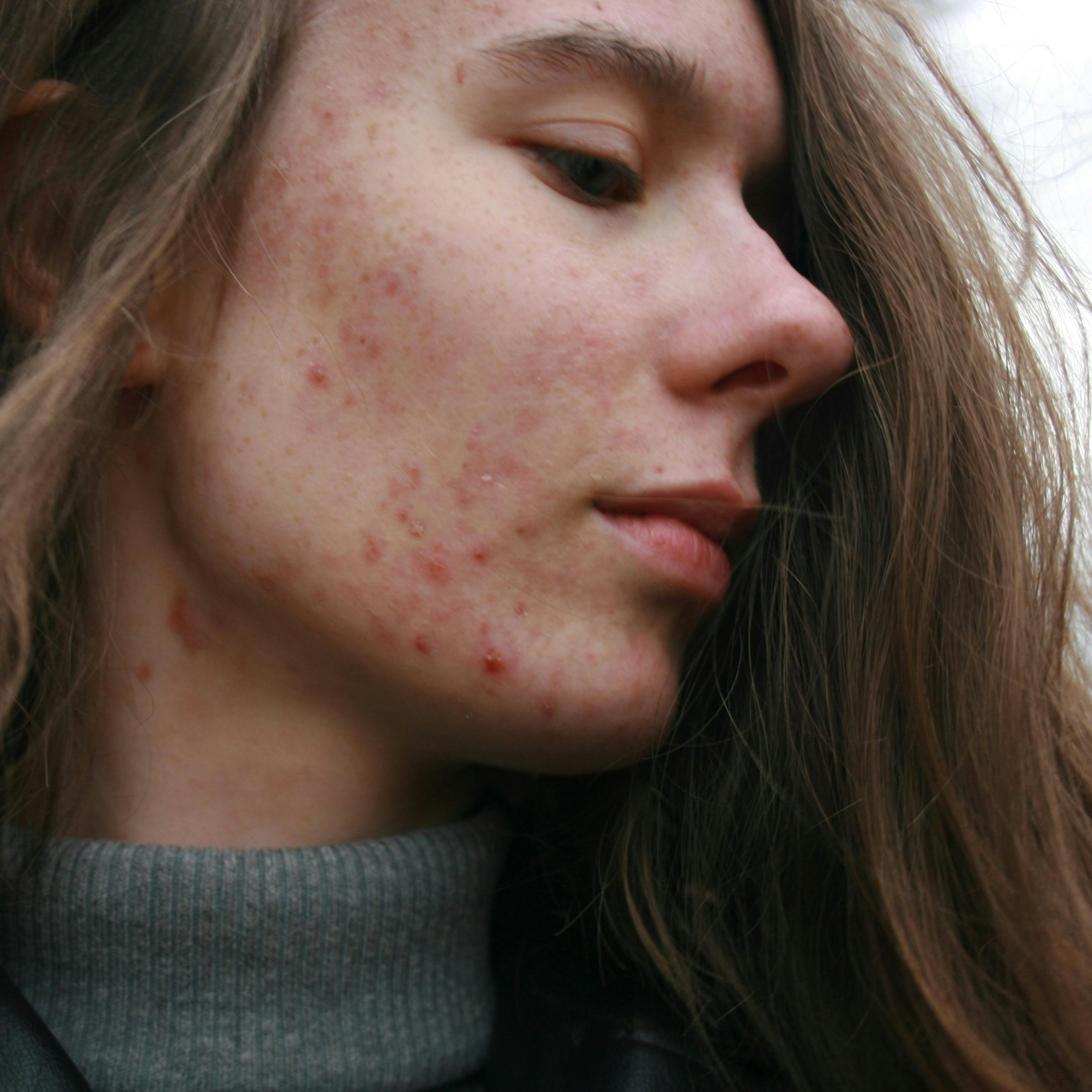 https://imgix.femina.dk/2024-11-01/barbara-krysztofiak-SfkPaoE_i34-unsplash.jpg