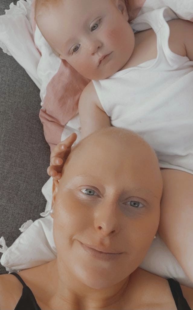 Sandra Andersen med barberet isse og sønnen Milas som spæd