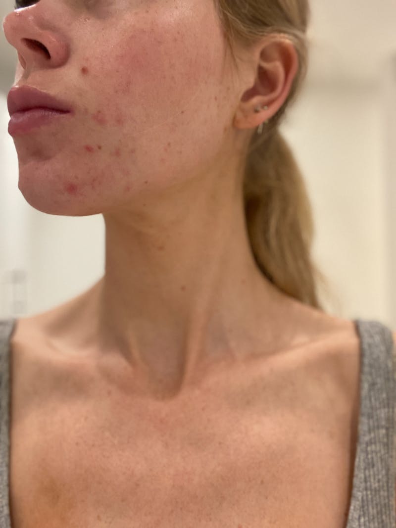 https://imgix.femina.dk/2025-05-03/rose2.jpg