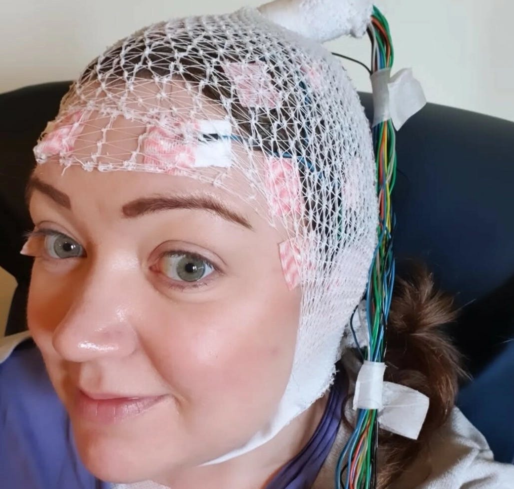 Hun blev bidt af en flåt – nu lever Anne-Marthe med epilepsi