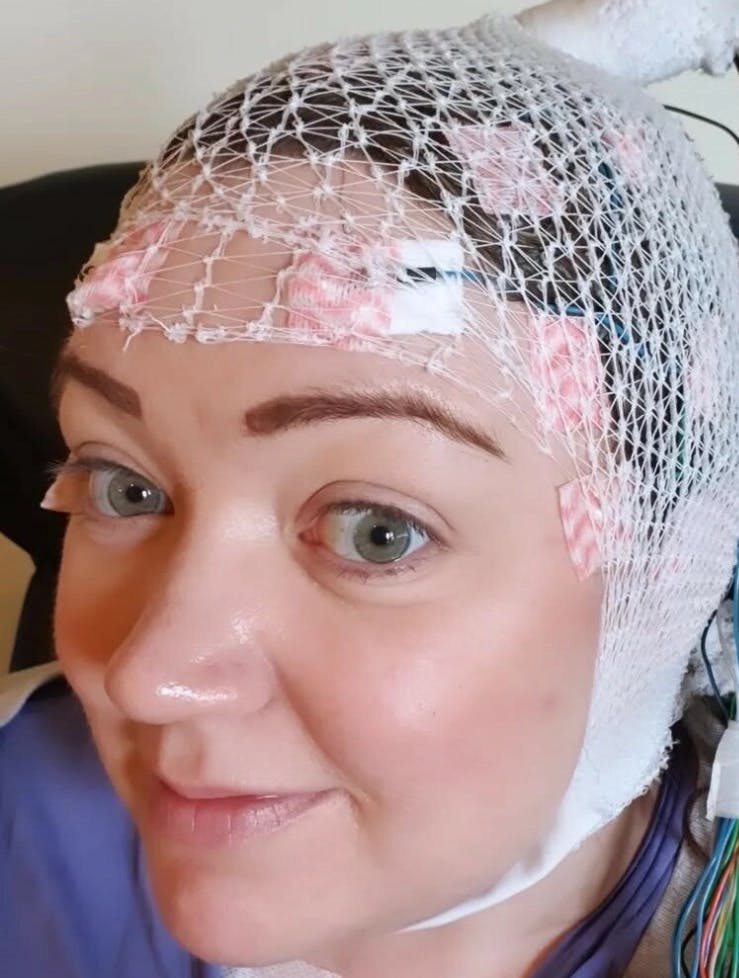 Hun blev bidt af en flåt – nu lever Anne-Marthe med epilepsi