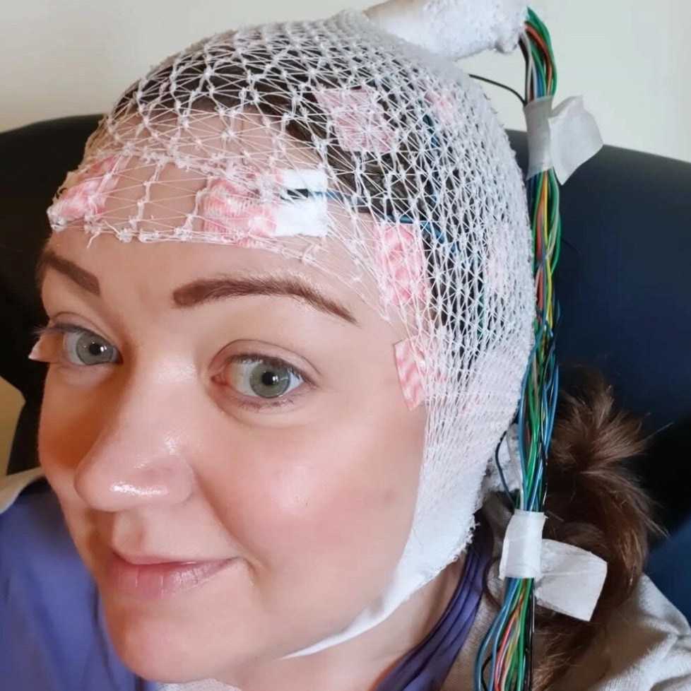 Hun blev bidt af en flĂ„t â nu lever Anne-Marthe med epilepsi