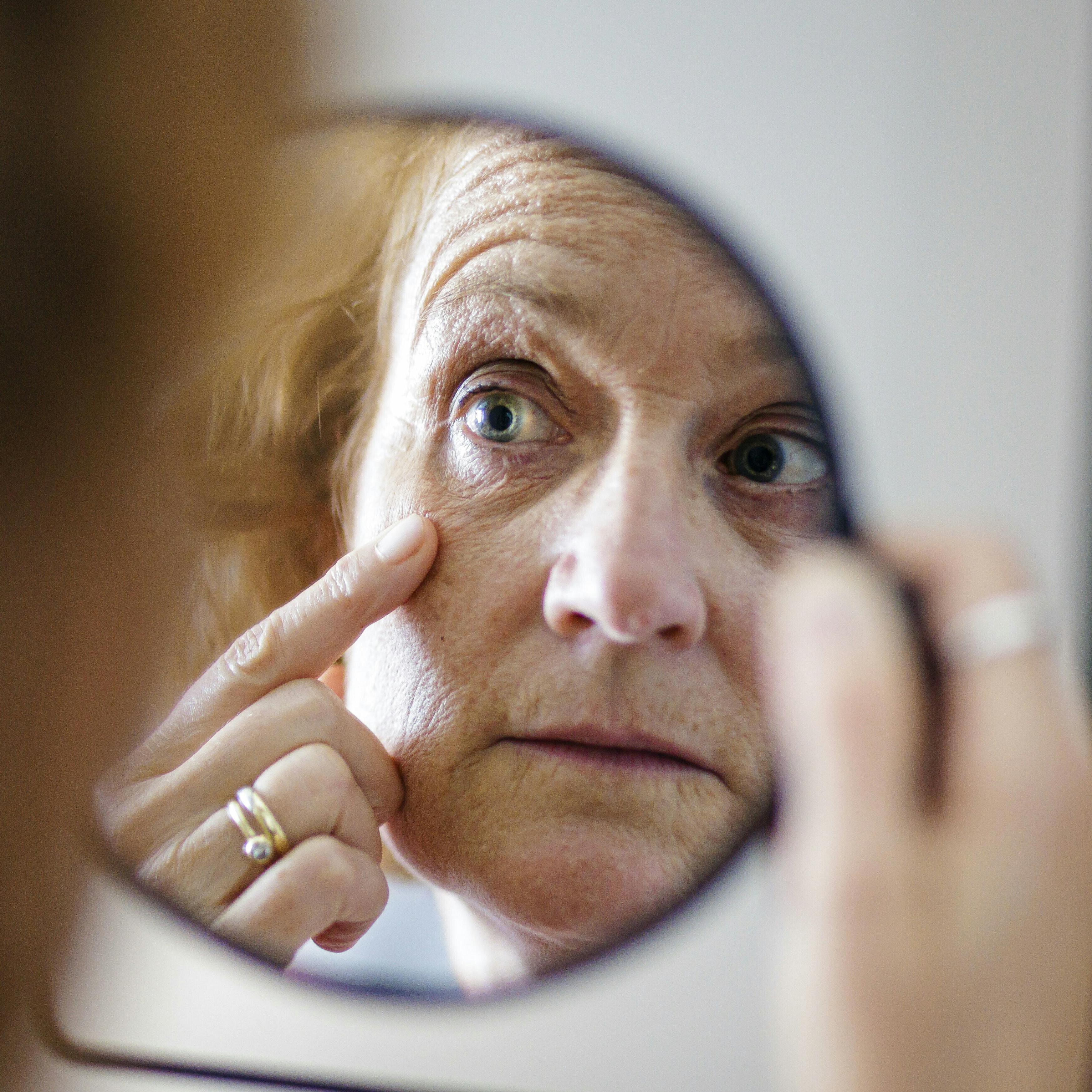 Ny forskning: Sådan opstår rynker i huden