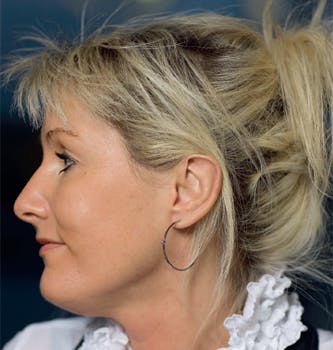 https://imgix.femina.dk/media/435259b9cbb74798a217133c6766d665.jpg