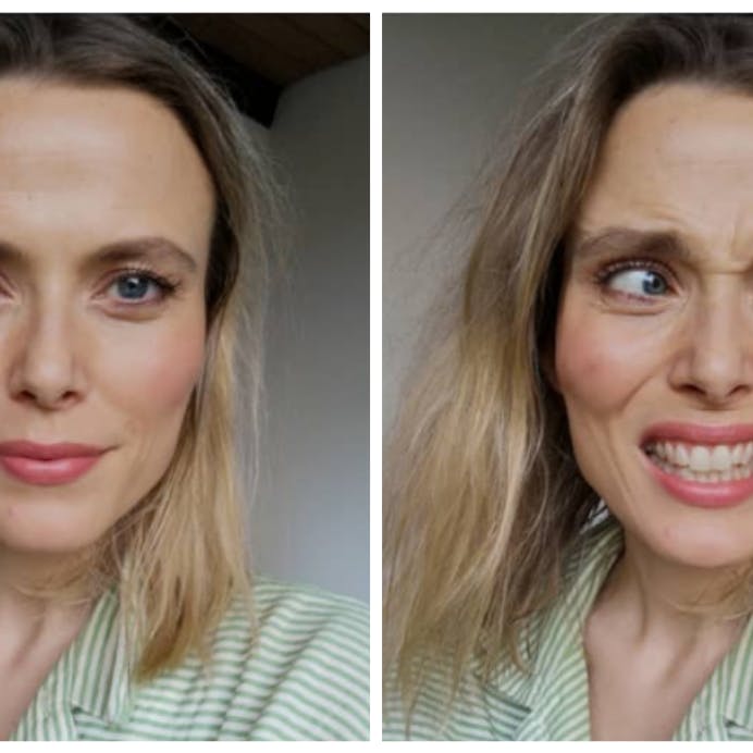 Cæcilie bruger botox: "Jeg vil vise folk, at sagtens kan se naturlig ud"