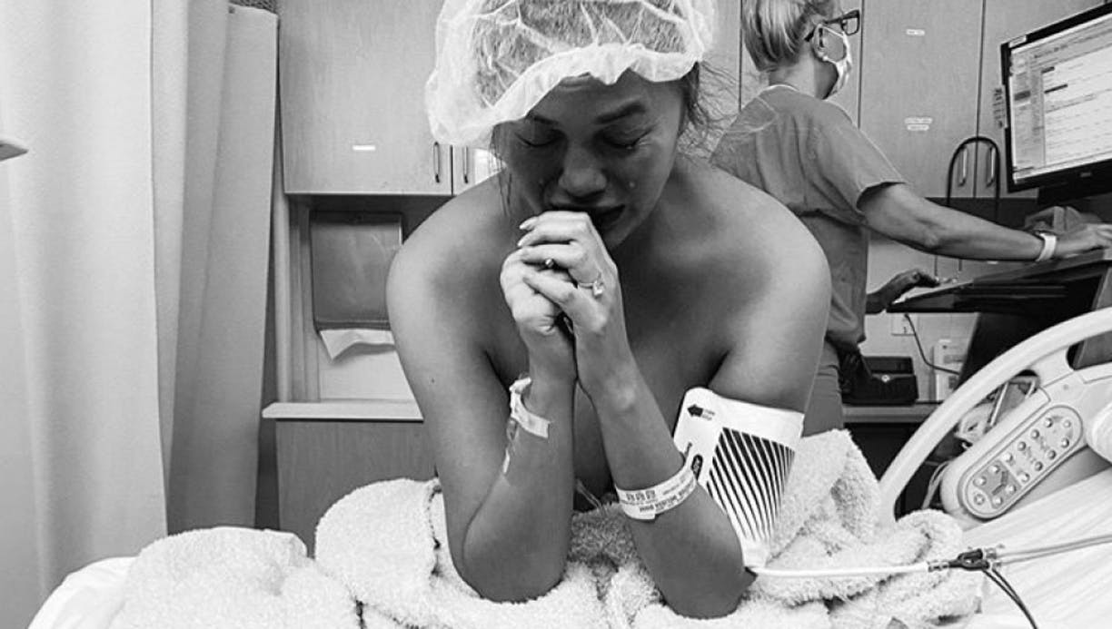 Chrissy Teigen