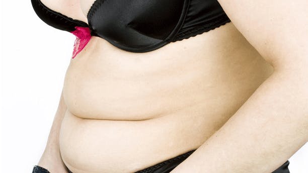 https://imgix.femina.dk/media/billeder/2012/august/tyndfedprim.jpg