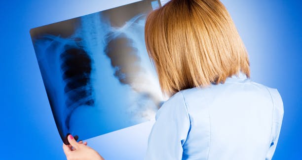 Symptomer på at din mand har kræft