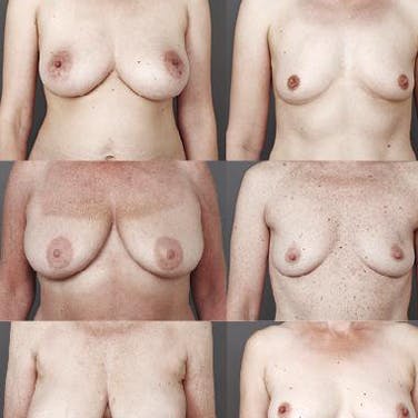 https://imgix.femina.dk/media/websites/femina-dot-dk/website/dig-og-dit-liv/taet-paa-dig/2012/09/1239-brystkampagne/1239-brystkampagne-art.jpg