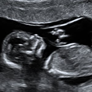 https://imgix.femina.dk/media/websites/mama/gravid/gravid-uge-for-uge/billeder-beskret/14prim.jpg