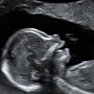 https://imgix.femina.dk/media/websites/mama/gravid/gravid-uge-for-uge/billeder-beskret/17prim.jpg