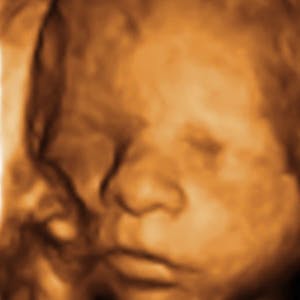 Gravid: Uge for uge - uge 24