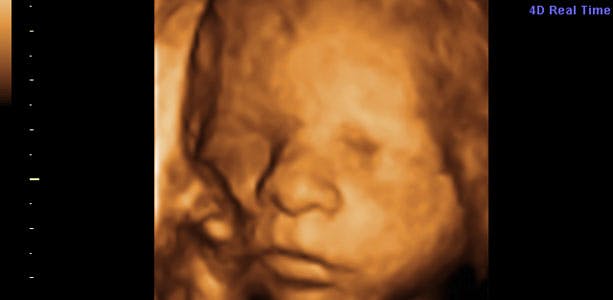 Gravid: Uge for uge - uge 24