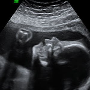 https://imgix.femina.dk/media/websites/mama/gravid/gravid-uge-for-uge/billeder-beskret/25prim.jpg