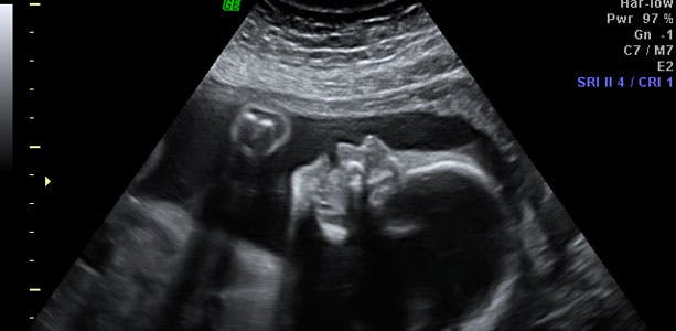 https://imgix.femina.dk/media/websites/mama/gravid/gravid-uge-for-uge/billeder-beskret/25prim.jpg