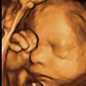 https://imgix.femina.dk/media/websites/mama/gravid/gravid-uge-for-uge/billeder-beskret/30prim.jpg