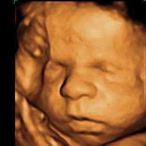 https://imgix.femina.dk/media/websites/mama/gravid/gravid-uge-for-uge/billeder-beskret/31prim.jpg