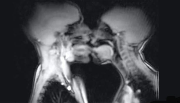 En MR-scanner kan bruges til lidt af hvert. Blandt andet kan den give os et helt fantastisk indblik i den menneskelige krop, også når den dyrker sex. Kig med og bliv forundret over at se de mest almindelige ting i hverdagen. - Indefra.